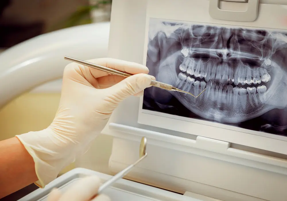 Çayyolu implant, Çayyolu implant tedavisi, Ankara Çayyolu implant, Ankara Çayyolu implant tedavisi, Çayyolu dental implant, Ankara implant tedavisi, Ankara dental implant, Çayyolu implant diş, Çayyolu tek diş implant, Çayyolu All-on-4 implant, Çayyolu All-on-6 implant, Çayyolu tam diş implant, Çayyolu çoklu diş implant, Çayyolu implant diş kliniği, Çayyolu implant diş hekimi, Ankara implant diş kliniği, Çayyolu sinüs lifting, Çayyolu kemik grefti implant, Alacaatlı implant tedavisi, Çankaya implant tedavisi